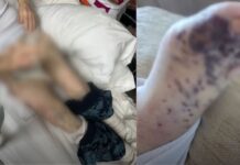 Una extrabajadora denuncia agresiones y vejaciones en una residencia de Torrejón
